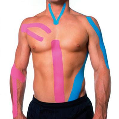 Кинезиотейпирование при болях в спине