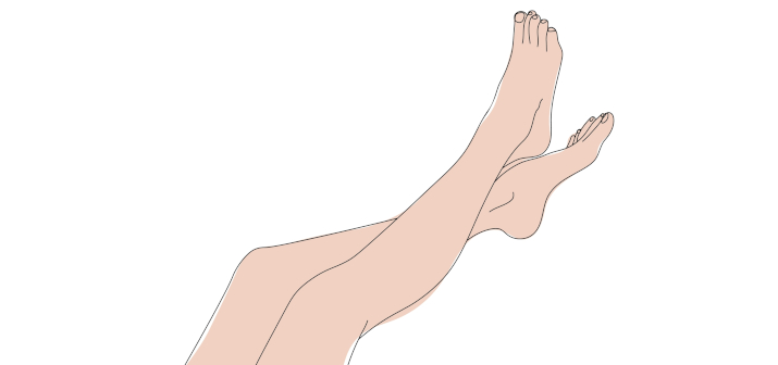 Профилактика варикоза