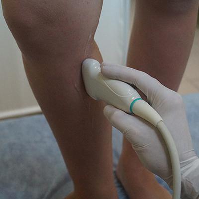 Дуплексное сканирование сосудов нижних конечностей