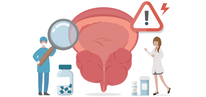 Острый простатит