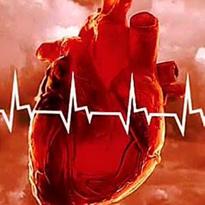 Россия лидирует по числу сердечно-сосудистых заболеваний