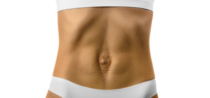 Диастаз прямых мышц живота