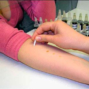 Обследование на аллергены