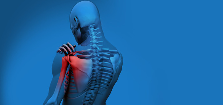 Импиджмент-синдром, или плечелопаточный периартрит