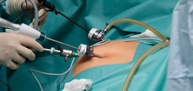 Гидронефроз: особенности заболевания почек