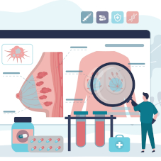 Фиброаденома молочной железы