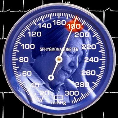 Артериальная гипертония ведет к старению мозга