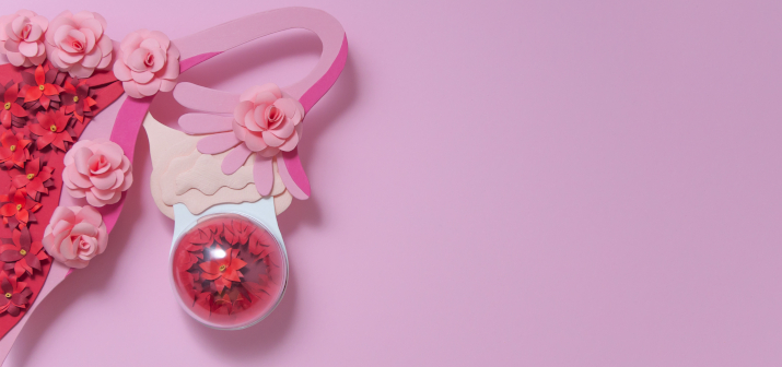 Эндометриоидная киста яичника