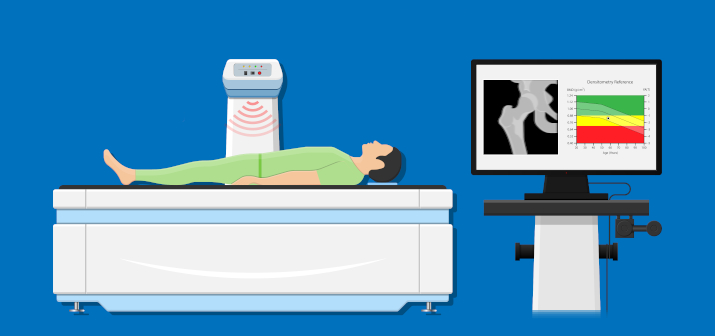 Денситометрия