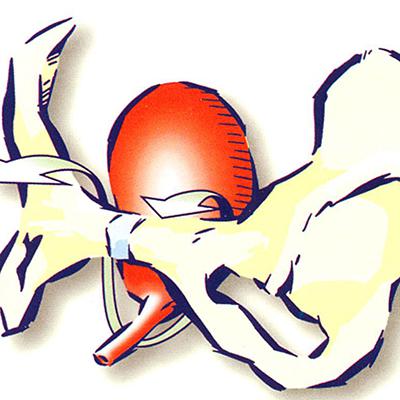 Кольпорафия: особенности пластики влагалища