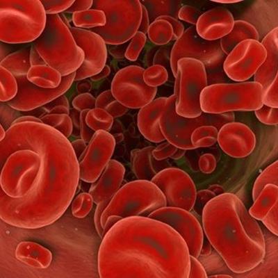 Гемохроматоз: все, что нужно знать о нарушениях обмена железа в организме