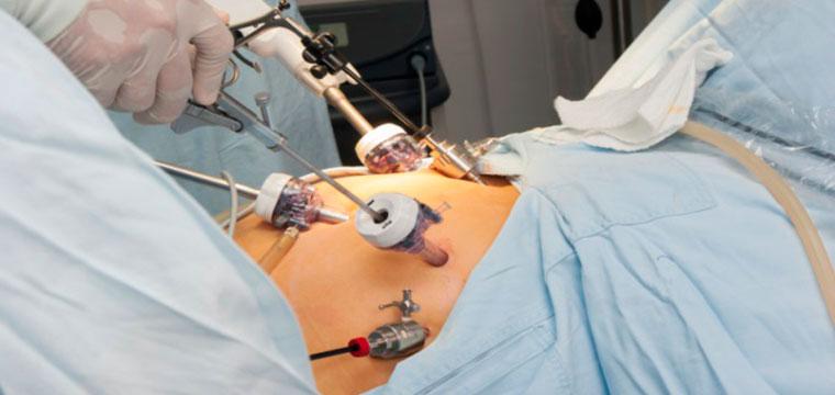 Новое в хирургии грыж