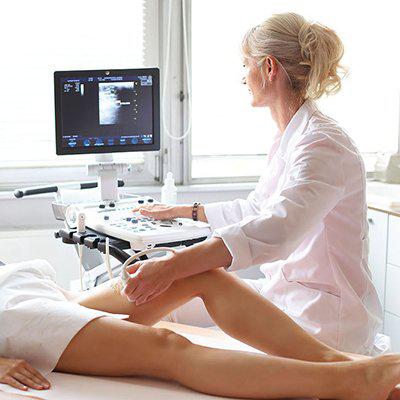 УЗИ вен конечностей – залог успеха в борьбе с варикозом