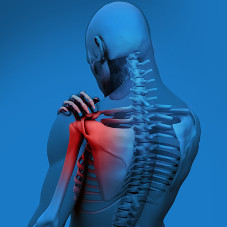 Импиджмент-синдром, или плечелопаточный периартрит