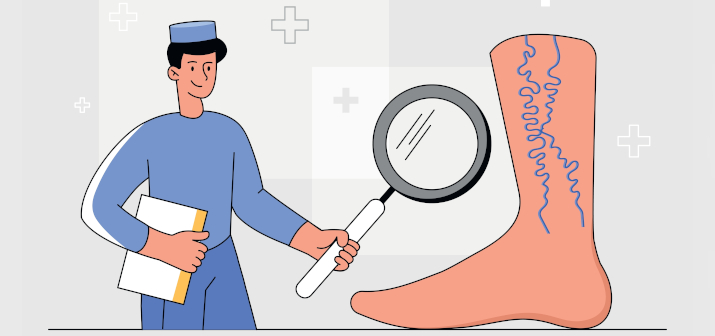 Лечение варикоза у мужчин