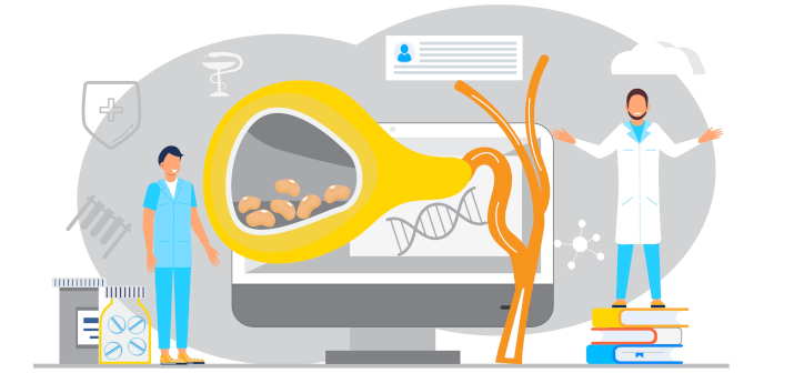 Острый холецистит