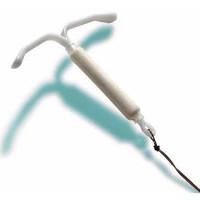 Внутриматочная спираль: особенности ВМС