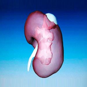 Киста почки: особенности полостных образований в почке