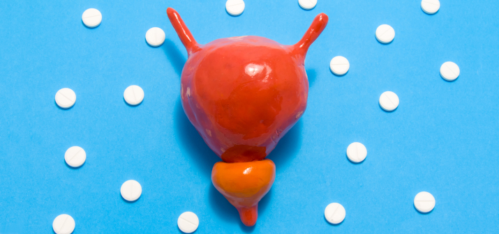 Калькулезный простатит