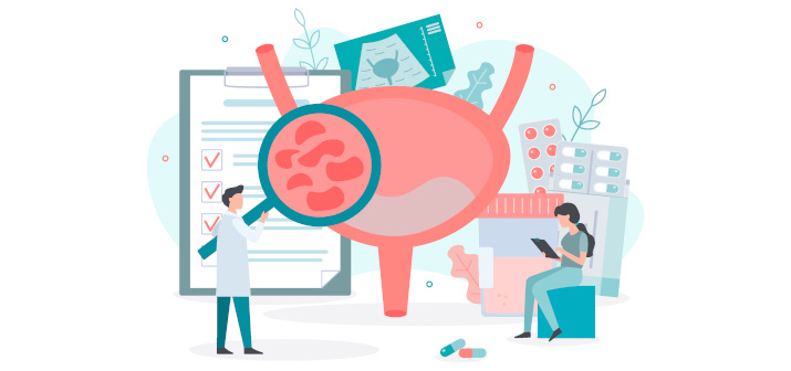 Все, что нужно знать о цистите