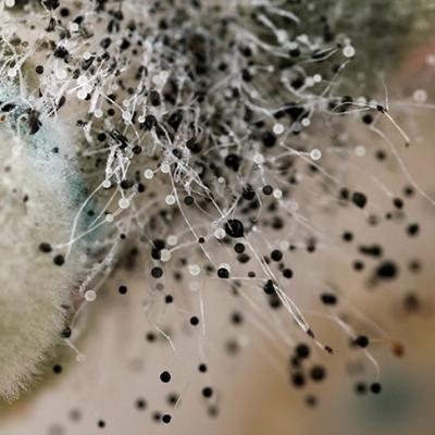 Отомикоз: инфекционное заболевание уха