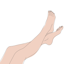 Профилактика варикоза