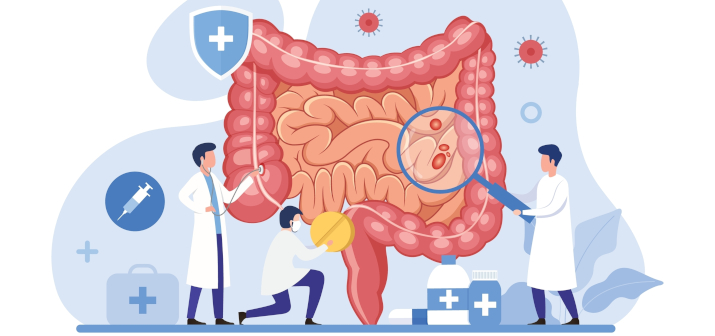 Что лучше: колоноскопия или МРТ кишечника