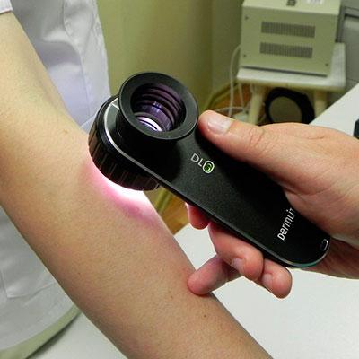 Необычные родинки