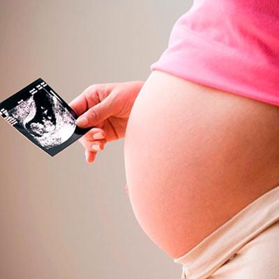 УЗИ при беременности