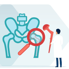 Эндопротезирование