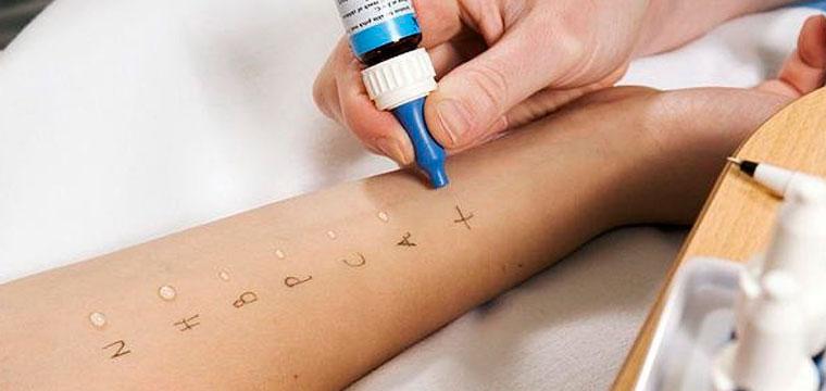 Обследование на аллергены