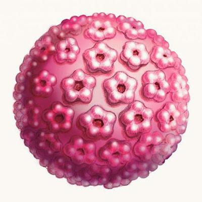 ВПЧ грозит инфарктом?