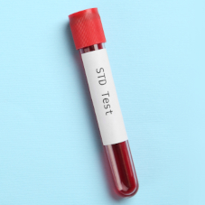 Первичный сифилис