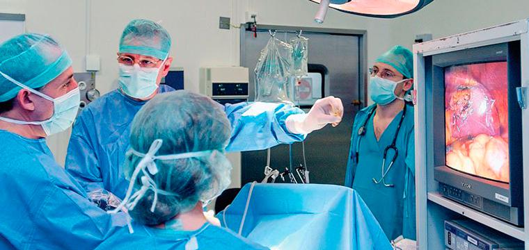 Лапароскопическая сальпингэктомия