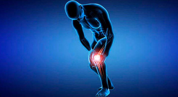 Тендинит: симптомы и лечение воспаления тканей сухожилий