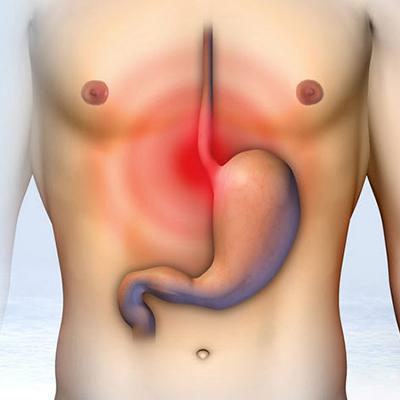 Диспепсия: особенности нарушенного пищеварения