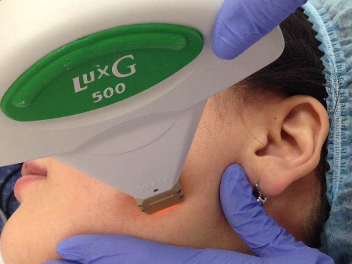 Фототерапия — передовой метод удаления пигментных пятен