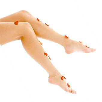 Лазерное лечение варикозного расширения вен