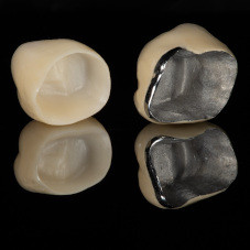 Коронки из металлокерамики, керамики (E-max) и циркония