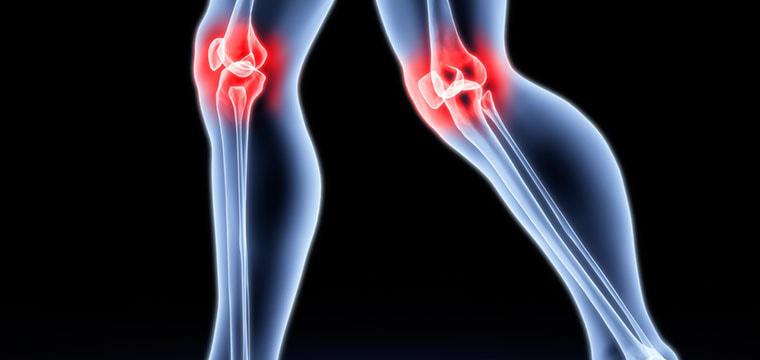 Крысы помогут в борьбе с артритом