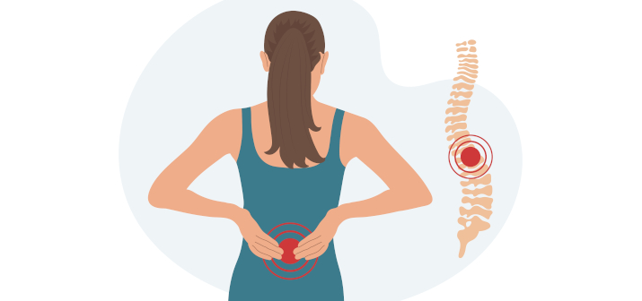 Перелом позвоночника