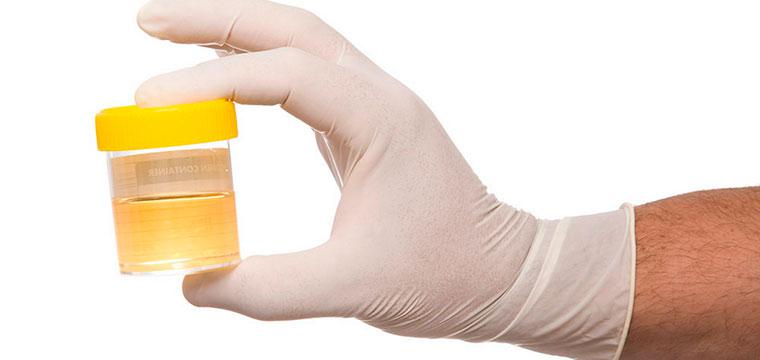 Пузырно-мочеточниковый рефлюкс: как избавиться от ПМР