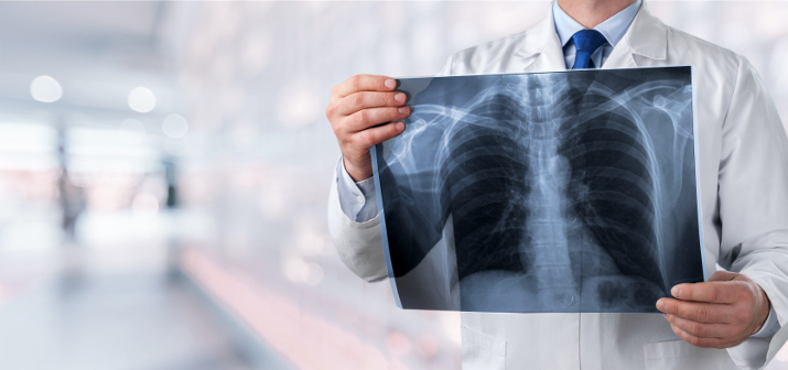 Легкие на просвет