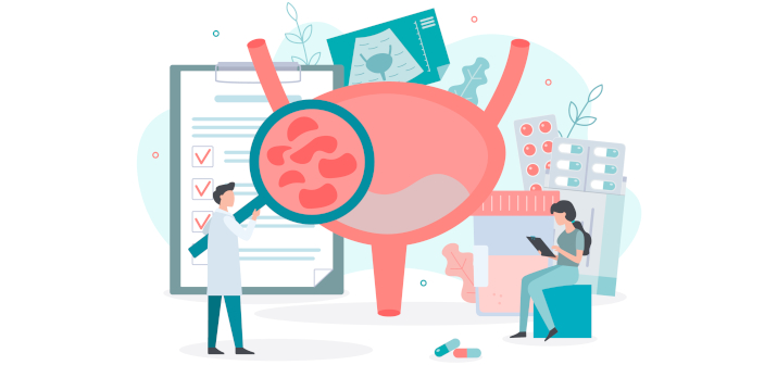 Камни в мочевом пузыре