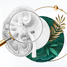 Nephro Check Up. Оценка состояния мочевыделительной системы (скрининг)