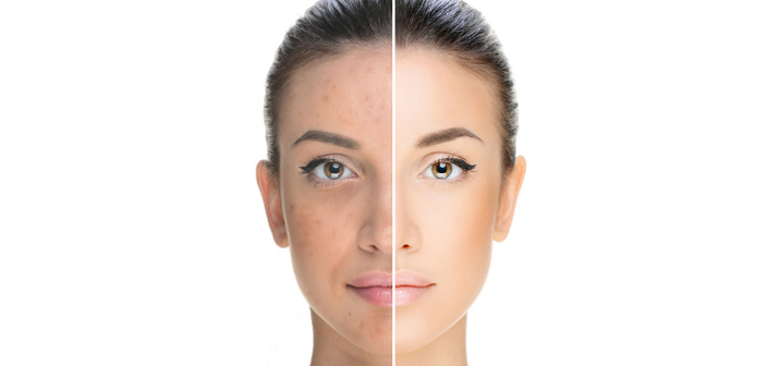 Биоревитализация: секрет вашей молодости