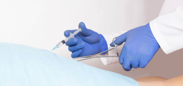 Лигирование