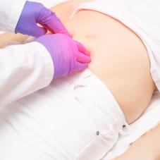 Пупочная грыжа: нужна ли операция