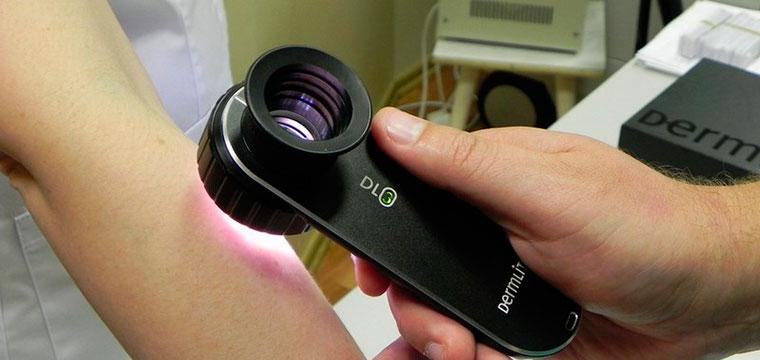 Необычные родинки