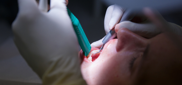 Болезни зубов